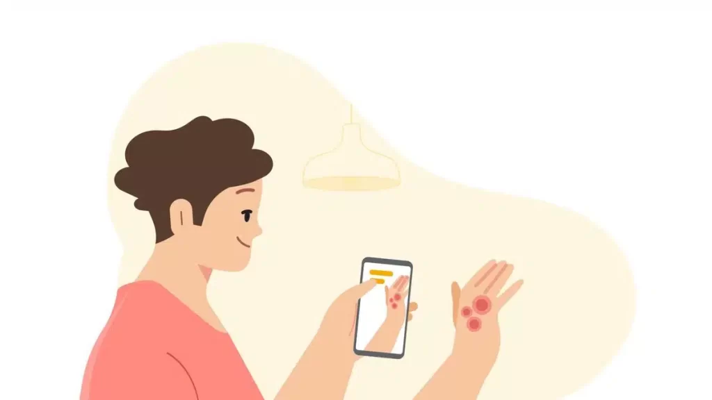 Google Lens now helps diagnose skin conditions